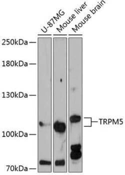 TRPM5 Antibody - Azide and BSA Free, Novus Biologicals 0.02 mL; Unconjugated:Antibodies,