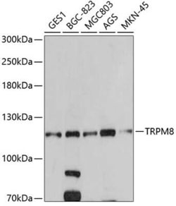 TRPM8 Antibody - BSA Free, Novus Biologicals 0.1 mL; Unconjugated:Antibodies,