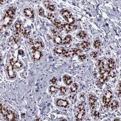 TRPS1 Antibody, Novus Biologicals:Antibodies:Primary Antibodies