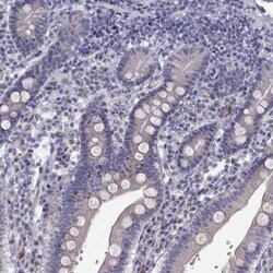 TRPS1 Antibody, Novus Biologicals:Antibodies:Primary Antibodies