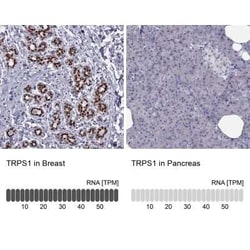 TRPS1 Antibody, Novus Biologicals:Antibodies:Primary Antibodies
