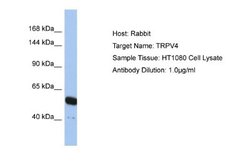 TRPV4 Rabbit anti-Human, Polyclonal, Novus Biologicals 0.1 mL | Buy Online | Novus Biologicals | Fisher Scientific
