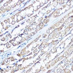 TRPV6 Antibody - Azide and BSA Free, Novus Biologicals 0.02 mL; Unconjugated:Antibodies,