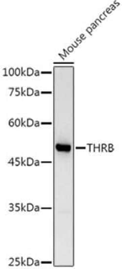 TR beta 1/NR1A2/Thyroid Hormone Receptor beta Antibody - Azide and BSA