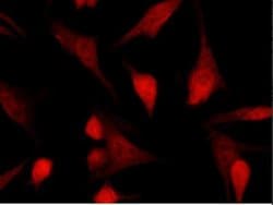 TSC22/TSC22D1 Rabbit anti-Human, Clone: 43, Novus Biologicals:Antibodies:Primary