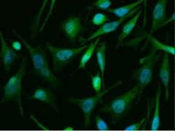TSC22/TSC22D1 Rabbit anti-Human, Clone: 143, Novus Biologicals 100 &mu;g;