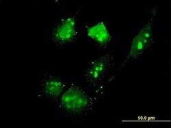 TSC22D4 Antibody (3C5), Novus Biologicals 0.1 mg; Unconjugated:Antibodies,