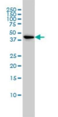 TSC22D4 Antibody (3C5), Novus Biologicals 0.1 mg; Unconjugated:Antibodies,