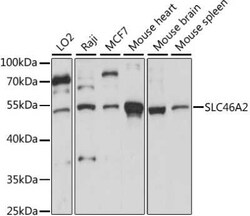 TSCOT Antibody - Azide and BSA Free, Novus Biologicals:Antibodies:Primary