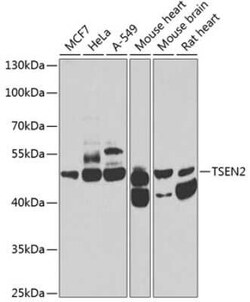 TSEN2 Antibody - BSA Free, Novus Biologicals 0.1 mL | Buy Online | Novus Biologicals | Fisher Scientific