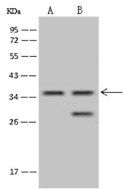 TSEN34 Antibody, Novus Biologicals:Antibodies:Primary Antibodies