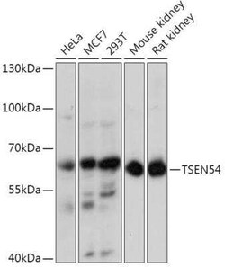 TSEN54 Antibody - Azide and BSA Free, Novus Biologicals 0.02 mL | Buy Online | Novus Biologicals | Fisher Scientific