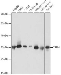 TSFM Antibody - Azide and BSA Free, Novus Biologicals 0.02 mL; Unconjugated:Antibodies,