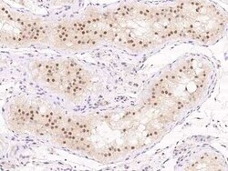 TSG-9 Antibody, Novus Biologicals 100 &mu;g; Unconjugated:Antibodies, Polyclonal