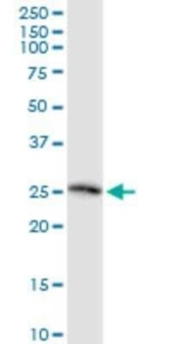 TSG Antibody (2F3), Novus Biologicals 0.1 mg | Buy Online | Novus Biologicals | Fisher Scientific