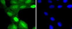 TSG101 Antibody (JJ0900), Novus Biologicals 100&mu;L:Antibodies, Monoclonal