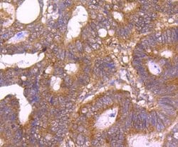 TSG101 Antibody (JJ0900), Novus Biologicals 100&mu;L:Antibodies, Monoclonal