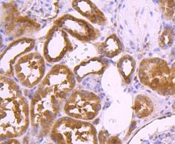 TSG101 Antibody (JJ0900), Novus Biologicals 100&mu;L:Antibodies, Monoclonal