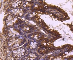 TSG101 Antibody (JJ0900), Novus Biologicals 100&mu;L:Antibodies, Monoclonal