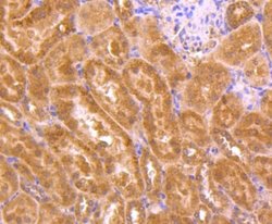 TSG101 Antibody (JJ0900), Novus Biologicals 100&mu;L:Antibodies, Monoclonal