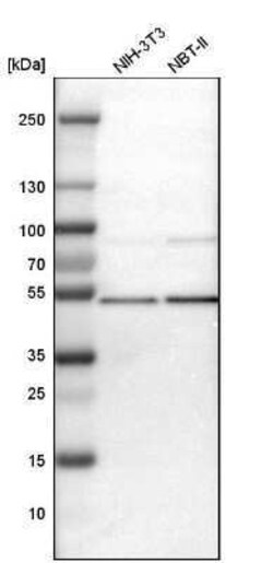 TSG101 Antibody, Novus Biologicals:Antibodies:Primary Antibodies