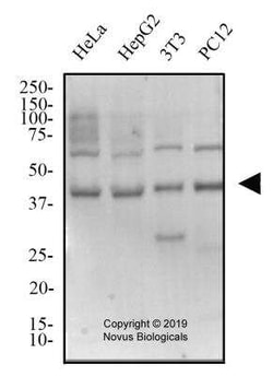 TSG101 Antibody - BSA Free, Novus Biologicals:Antibodies:Primary Antibodies