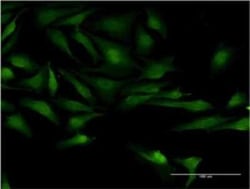 TSGA10 Antibody (6E8), Novus Biologicals 0.1 mg | Buy Online | Novus Biologicals | Fisher Scientific