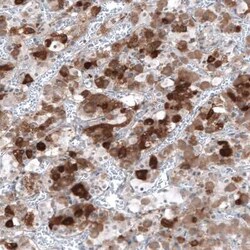 TSH beta Antibody, Novus Biologicals:Antibodies:Primary Antibodies