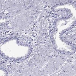 TSH beta Antibody, Novus Biologicals:Antibodies:Primary Antibodies