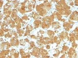 TSHR Antibody (TSHRA/1402), Novus Biologicals:Antibodies:Primary Antibodies