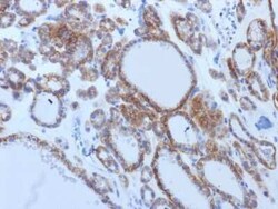 TSHR Antibody (TSHRB/1405), Novus Biologicals:Antibodies:Primary Antibodies