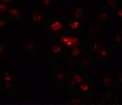 TSHZ2 Antibody - BSA Free, Novus Biologicals 0.1 mg | Buy Online | Novus Biologicals | Fisher Scientific