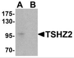 TSHZ2 Antibody - BSA Free, Novus Biologicals 0.1 mg | Buy Online | Novus Biologicals | Fisher Scientific