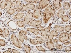 TSNAXIP1 Antibody, Novus Biologicals 0.05 mg | Buy Online | Novus Biologicals | Fisher Scientific