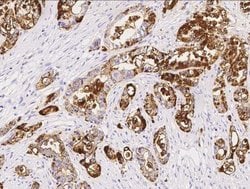 TSPAN1 Rabbit anti-Human, Clone: 10, Novus Biologicals 100 &mu;g; Unconjugated:Antibodies,
