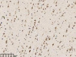 TSPAN3 Rabbit anti-Human, Polyclonal, Novus Biologicals 50 &mu;g | Buy Online | Bio-Techne | Fisher Scientific