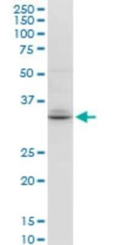 Novus Biologicals TSPAN32/TSSC6 Antibody (2G12), Novus Biologicals 0.1 mg | Buy Online | Novus Biologicals&trade; | Fisher Scientific