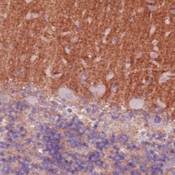 TSPAN7/TM4SF2 Antibody (CL0262), Novus Biologicals 25 &mu;L, Unconjugated:Antibodies,