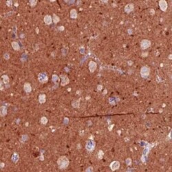 TSPAN7/TM4SF2 Antibody (CL0262), Novus Biologicals 25 &mu;L, Unconjugated:Antibodies,
