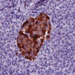TSPAN7/TM4SF2 Antibody (CL0262), Novus Biologicals 25 &mu;L, Unconjugated:Antibodies,