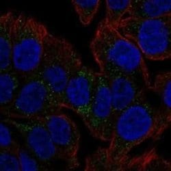 TSPAN8/TM4SF3 Rabbit anti-Human, Polyclonal, Novus Biologicals:Antibodies:Primary
