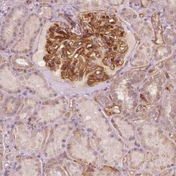 TSPO2 Antibody, Novus Biologicals 25 &mu;L, Unconjugated:Antibodies, Polyclonal