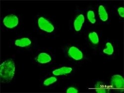 TSPYL1 Antibody (4F11), Novus Biologicals 0.1 mg | Buy Online | Novus Biologicals | Fisher Scientific