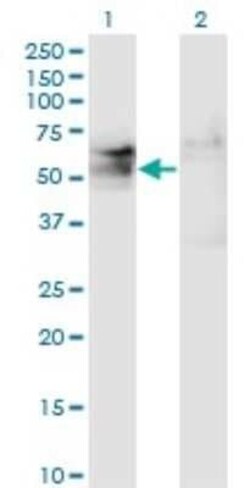 TSPYL1 Antibody (4F11), Novus Biologicals 0.1 mg | Buy Online | Novus Biologicals | Fisher Scientific