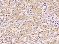 TSSC1 Antibody, Novus Biologicals 100 &mu;g, Unconjugated:Antibodies, Polyclonal