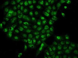 TSSC4 Antibody, Novus Biologicals™