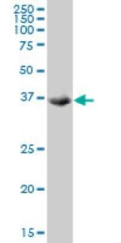 TSSK2 Antibody (1F6), Novus Biologicals 0.1 mg | Buy Online | Novus Biologicals | Fisher Scientific