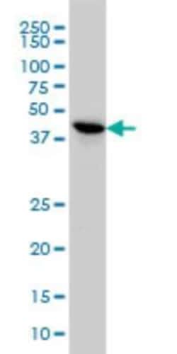 TSSK2 Antibody (1H2), Novus Biologicals 50 &mu;g | Buy Online | Novus Biologicals | Fisher Scientific