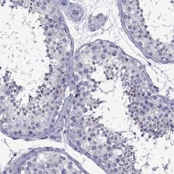 TSSK4 Antibody, Novus Biologicals:Antibodies:Primary Antibodies