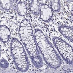 TSSK4 Antibody, Novus Biologicals:Antibodies:Primary Antibodies
